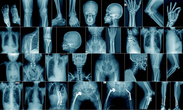 imagerie-medicale